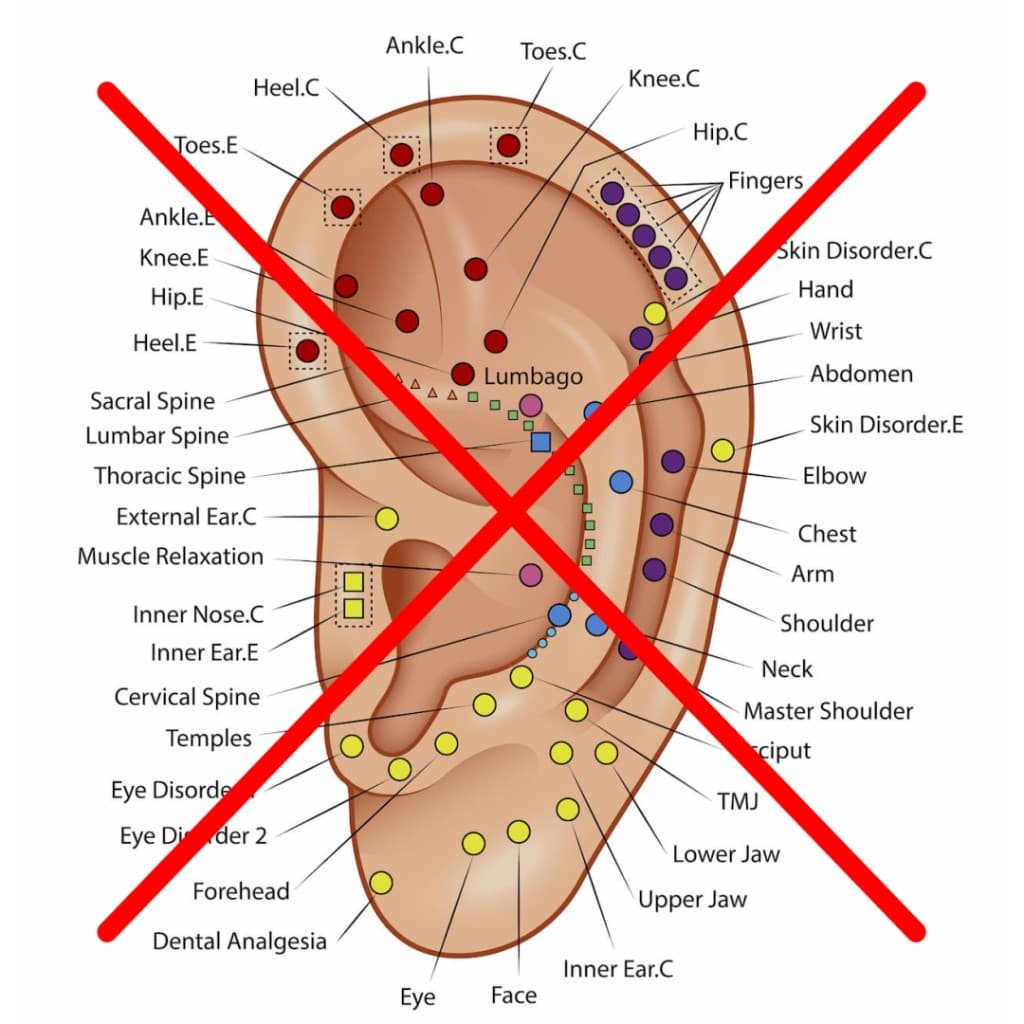 A crowded 2D ear chart with overlapping point labels, crossed out.